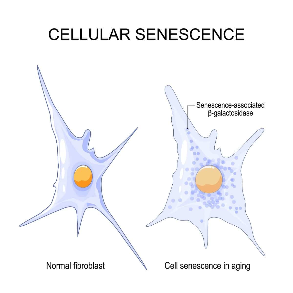 two cells one being a senescent cells suffering from cellular senescence and one cell being healthy