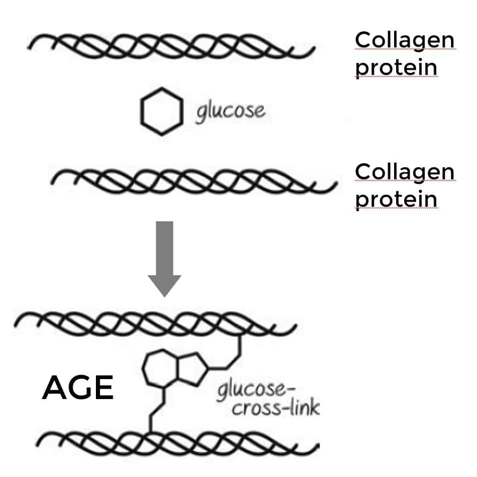 Glucose crosslink crosslinking two collagen proteins forming advanced glycation end products (AGEs)
