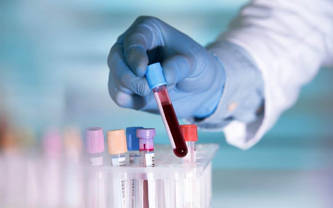 Shortcomings and Problems with Blood Lab Tests
