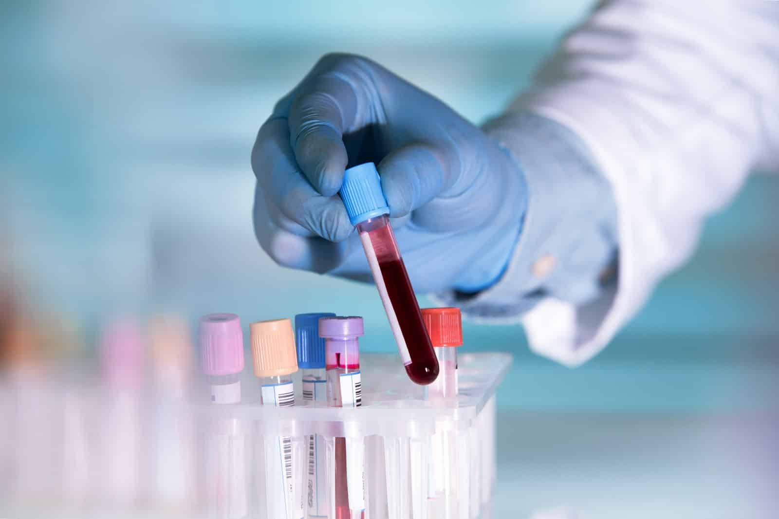 blood lab test blood panel tube