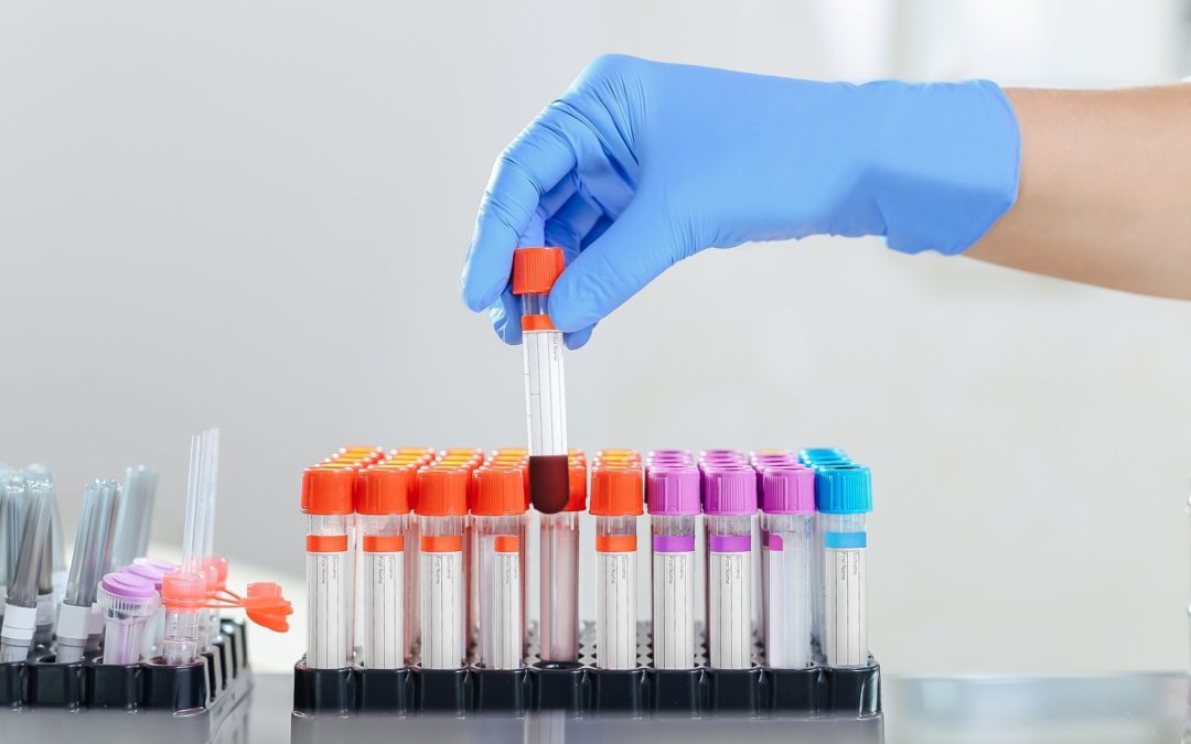 Which Blood Tests When Taking Rapamycin?